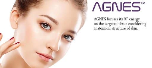 AGNES Acne Treatment - Effective and Fast Results