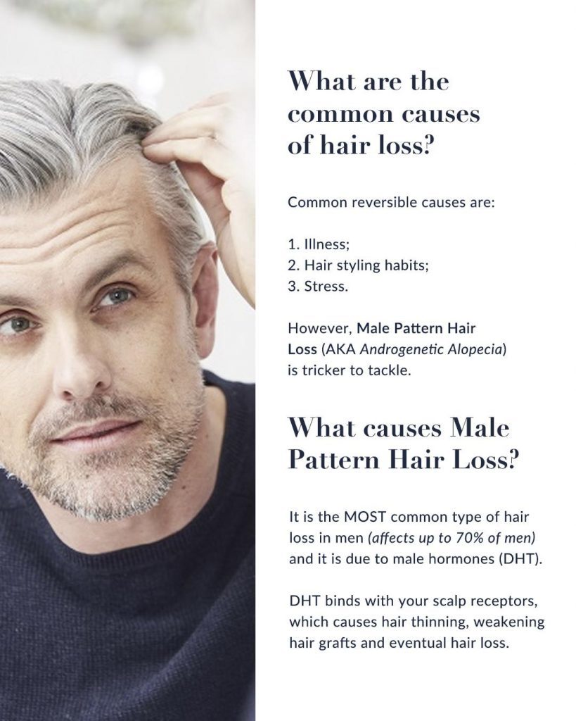 Cause of Male Pattern Hair Loss