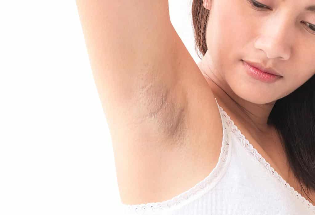 hormonal disorder causes dark underarms