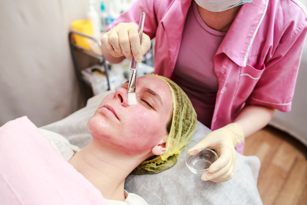 chemical peel for pigmentation removal