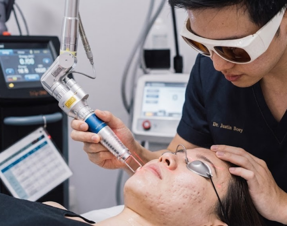 Interventions For Acne Scarring