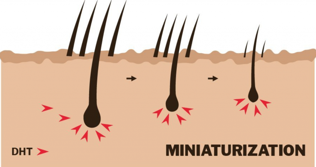 Miniaturisation process caused by male hormones