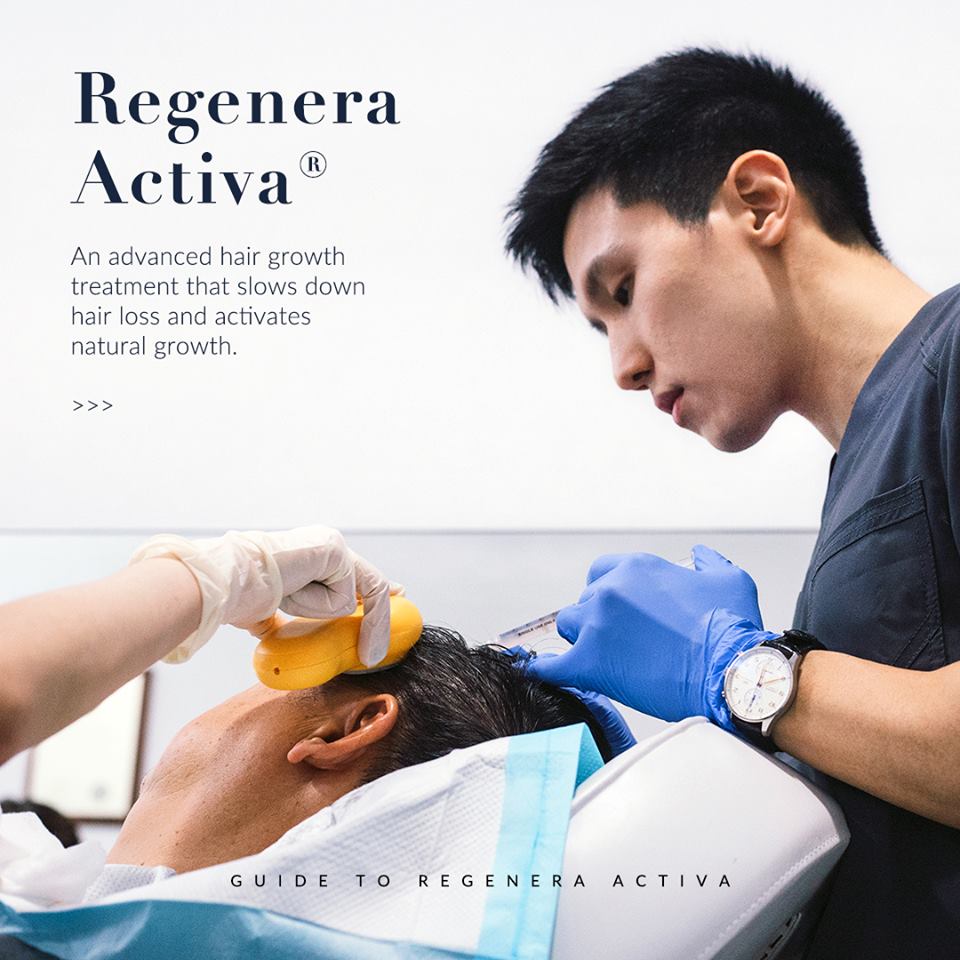 Regenera Activa Hair Transplant Raffles Place SG