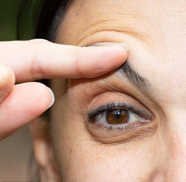 How to Get Rid of Eye Bags? An Expert's Guide