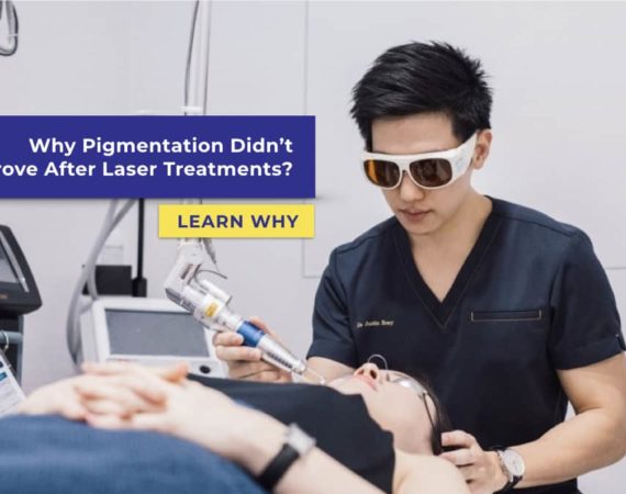 Why Pigmentation Didn’t Improve After Laser Treatments?