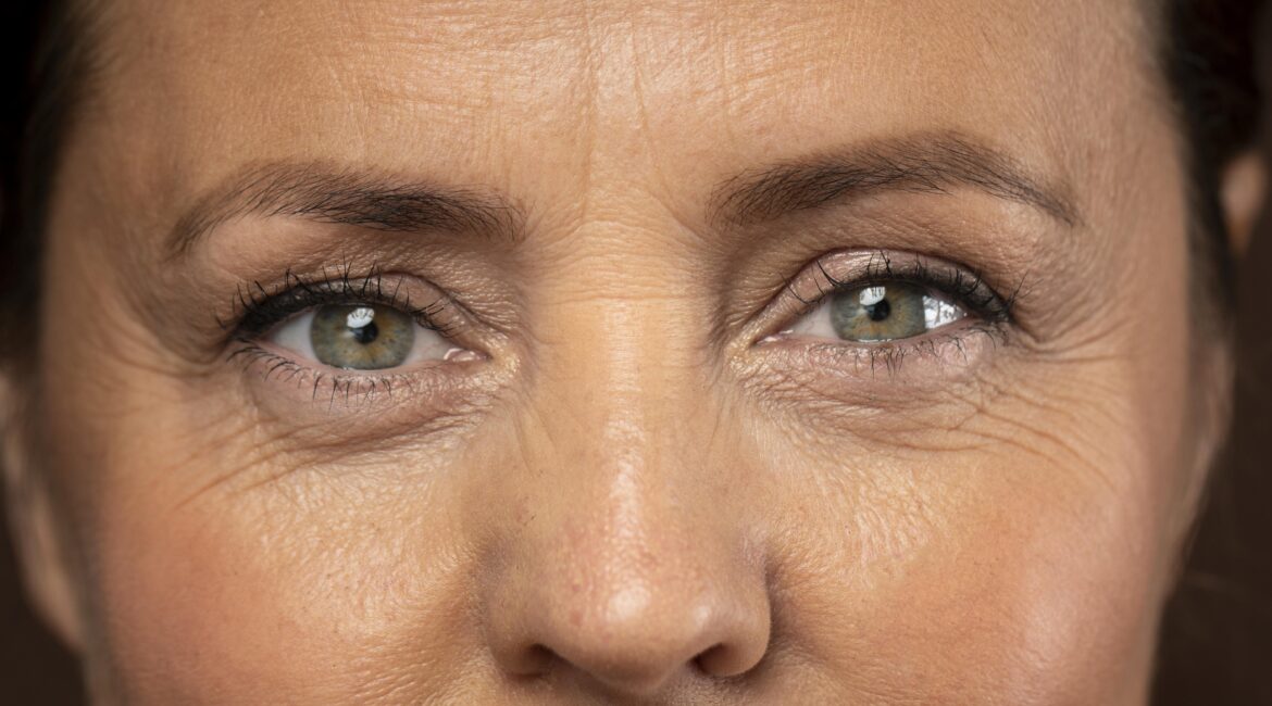 Woman with wrinkles