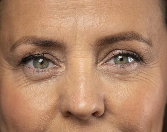 Woman with wrinkles