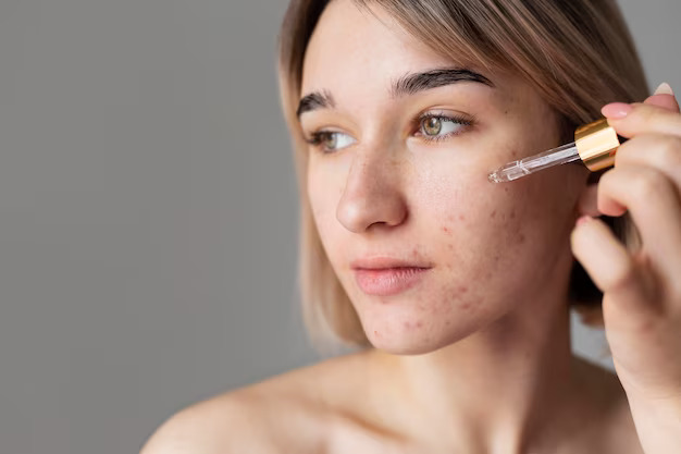 a woman trying different acne treatment