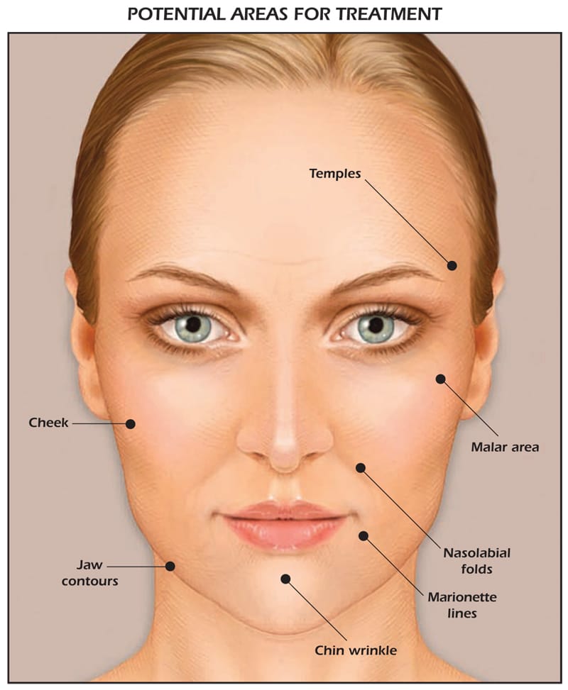 areas of the face to treat for saggy skin