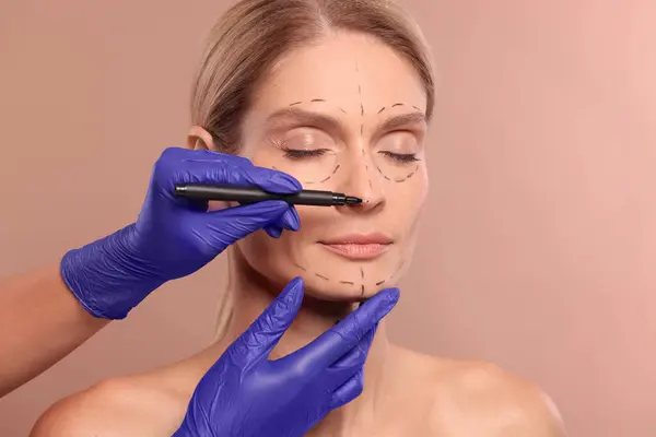 Traditional Facelift 