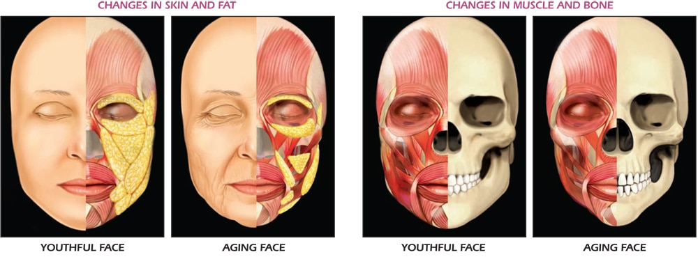 facial aging process