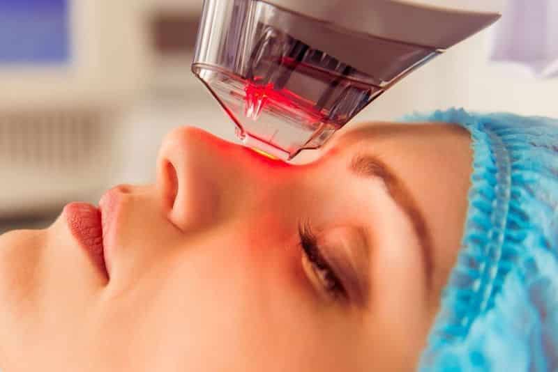 facial laser treatments in Singapore