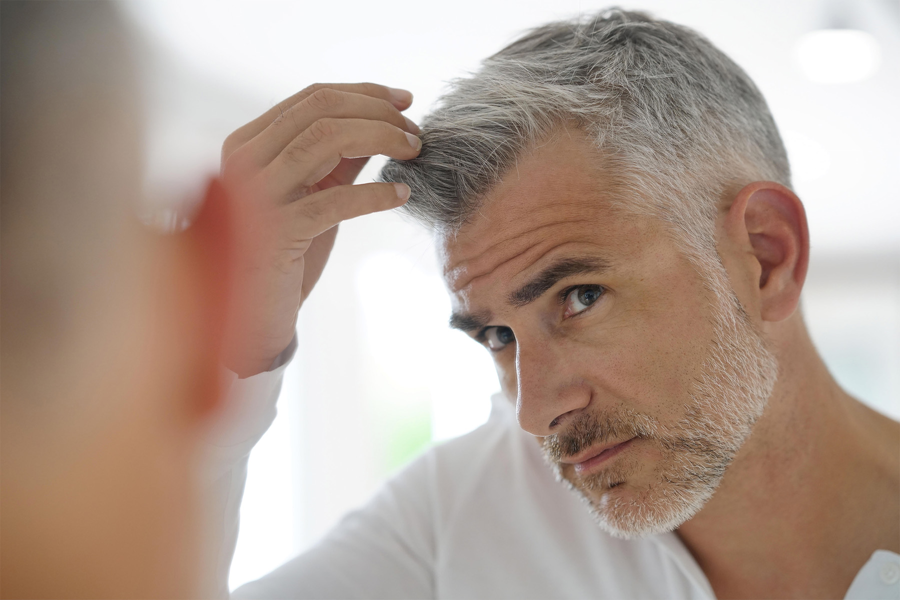 men hair loss