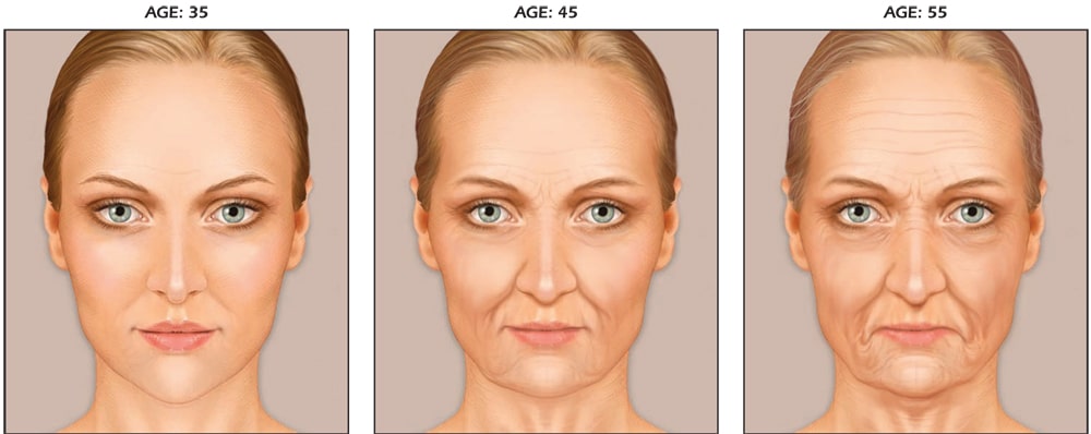 skin changes as you age